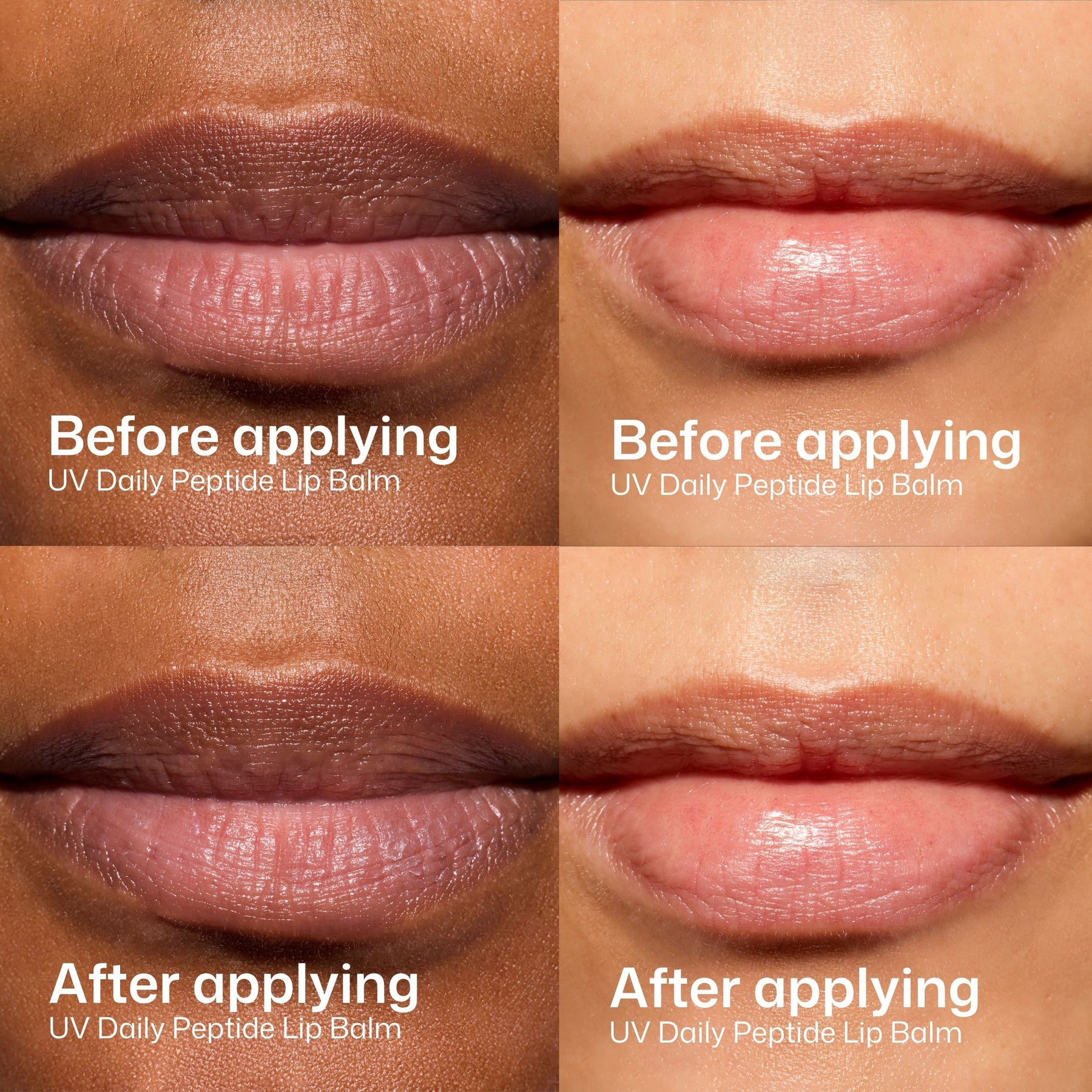 Before-and-after images showing lips before and after applying EltaMD UV Daily Peptide Lip Balm SPF 40.