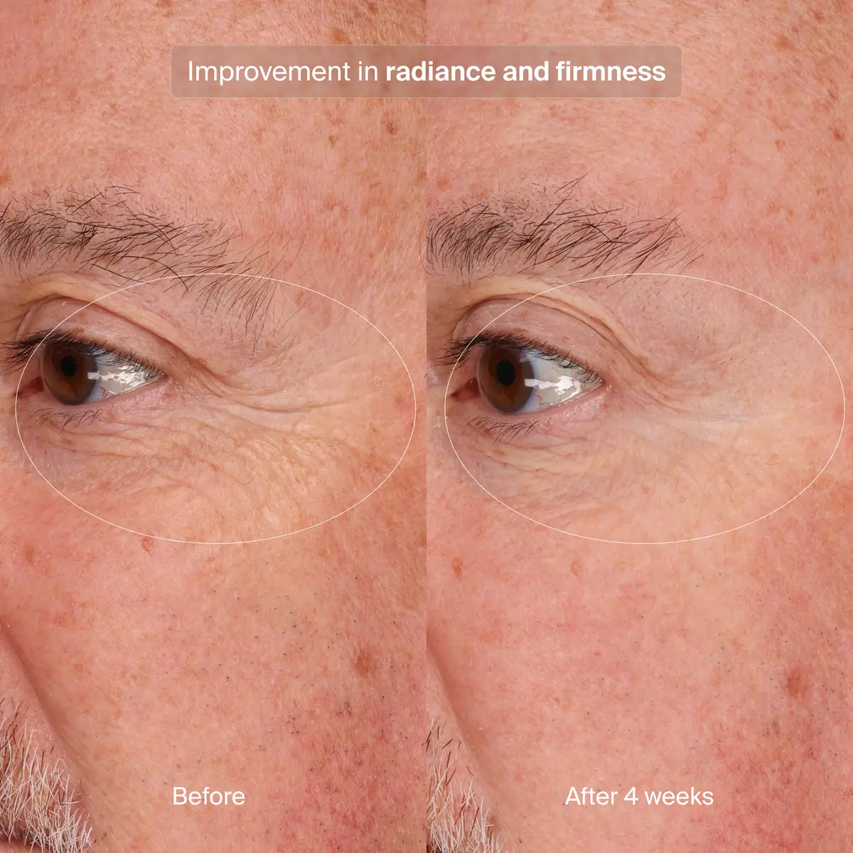 Before and after 4 weeks comparison of Pavise Precision Eye Lift for improvement in radiance and firmness.
