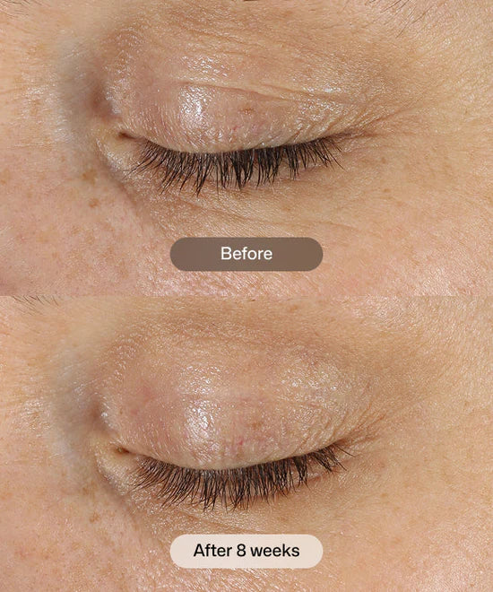 Before and after 8 weeks comparison of using Revision Skincare DEJ Eye Cream to firm, lift and smooth the total eye area.